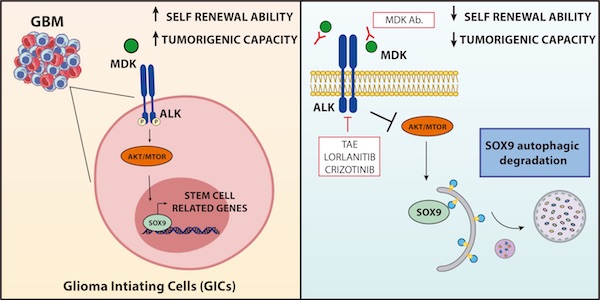 gliobastoma gruillermo velasco ucm tumor cerebral