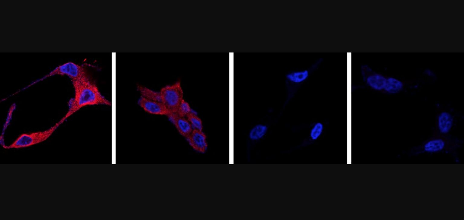 CSIC nanoparticulas cancer de prostata