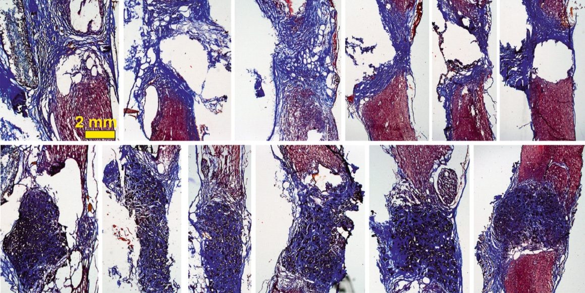 médula grafeno CSIC parapléjicos